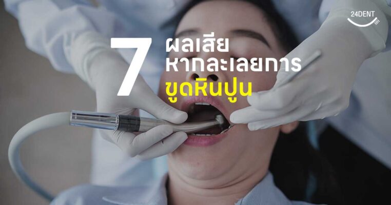 7 ผลเสียหากละเลยการขูดหินปูน